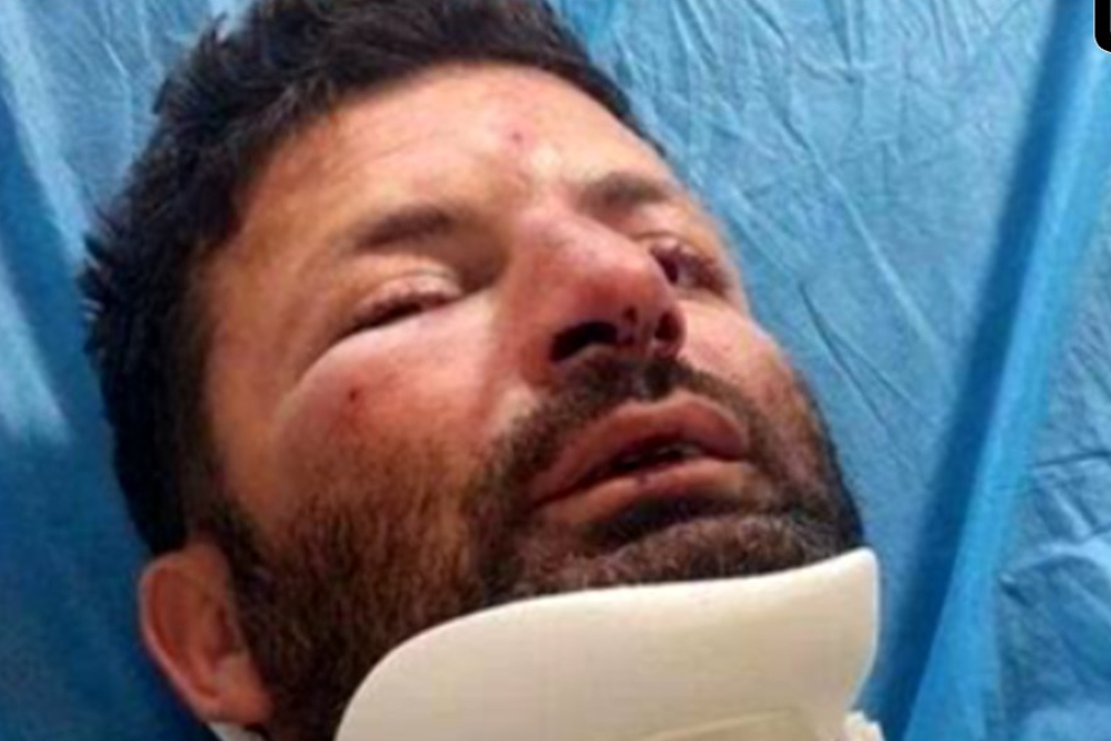 حمله ۳ متخلف به محیط‌بان در شمال تهران؛ ضاربان بازداشت شدند